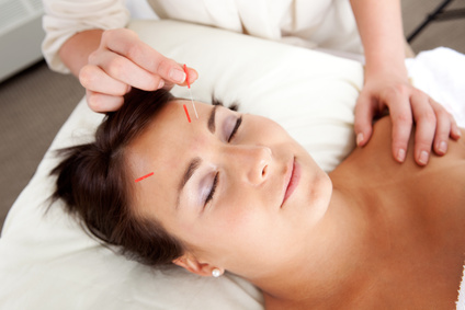 Akupunktur bei Migräne